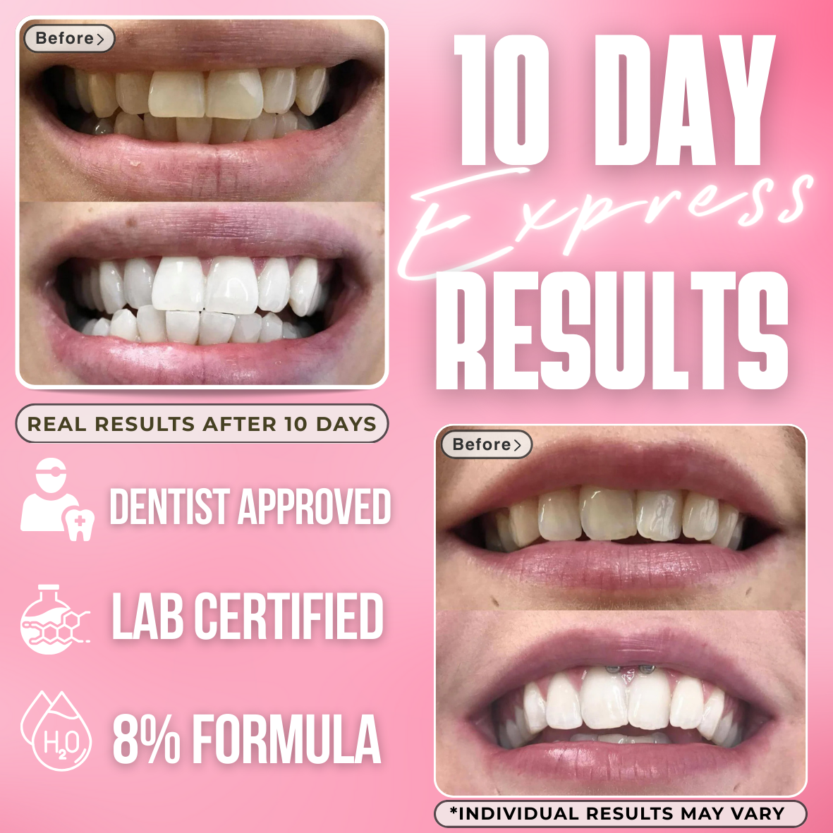 Glow Strips - 10 Express Teeth Whitening Strips & Pen | 8% Professional Whitening Formula