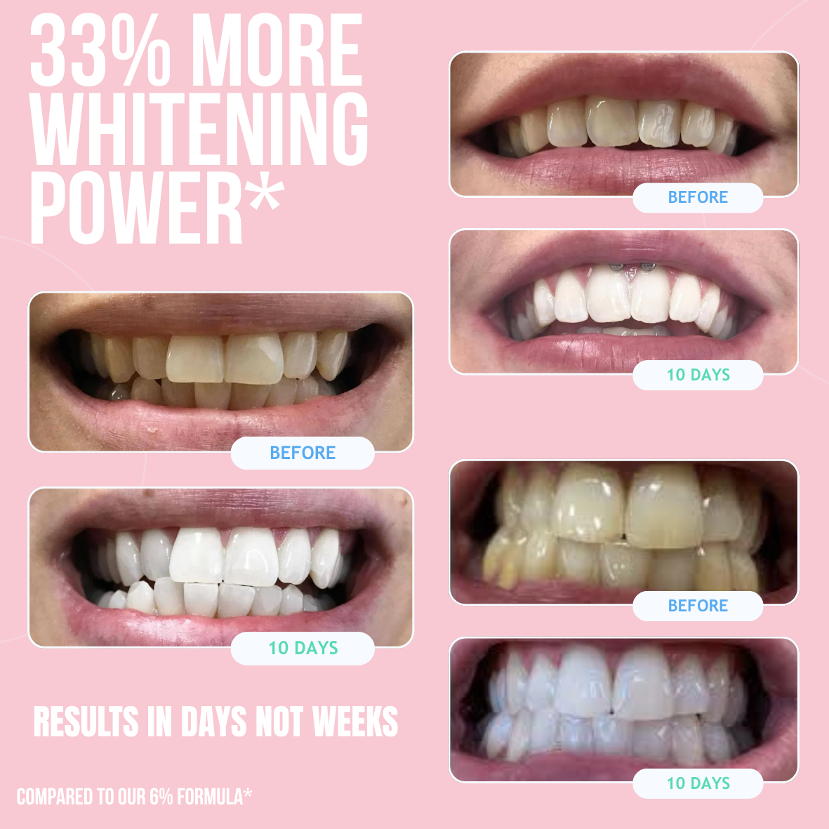 3-in-1 Teeth Whitening Kit, 14 Whitening Treatments + Post Whitening Enamel Care Toothpaste